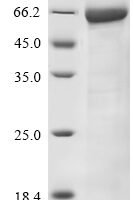 Rat Acetylcholinesterase (Ache) Recombinant Protein - BioCrest Sci