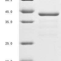 Human Coagulation factor IX (F9), partial Recombinant Protein, N-His-GST - BioCrest Sci