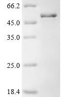 Mouse Slit homolog 2 protein (Slit2), partial Recombinant Protein, C-His - BioCrest Sci