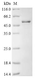 Mouse Slit homolog 2 protein (Slit2), partial Recombinant Protein, C-His, Mus musculus (Mouse), E.coli, C-terminal 6xHis-tagged, 51.5 kDa, purity >≥ 90% as determined by SDS-PAGE.