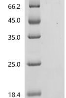 Human Growth/differentiation factor 9 (GDF9) Recombinant Protein, C-10His-HSA - BioCrest Sci