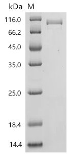 Human Growth/differentiation factor 9 (GDF9) Recombinant Protein, C-10His-HSA, Homo sapiens (Human), Mammalian cell, C-terminal 10xHis-HSA-tagged, 84.2 kDa, purity >≥ 90% as determined by SDS-PAGE.