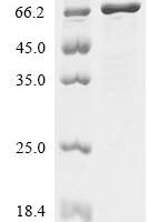 Escherichia coli Proline--tRNA ligase (proS) Recombinant Protein - BioCrest Sci