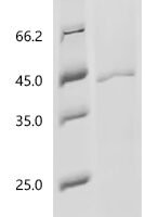 Porcine reproductive and respiratory syndrome virus Glycoprotein 4 (GP4),partial Recombinant Protein - BioCrest Sci