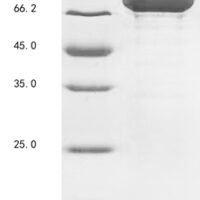 Human Heat shock cognate 71 kDa protein (HSPA8) Recombinant Protein - BioCrest Sci