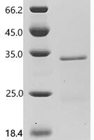 Pig tissue kallikrein (KLK5), partial Recombinant Protein, C-His - BioCrest Sci