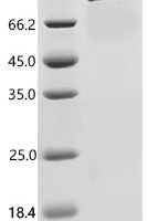Rat Insulin-like growth factor-binding protein 1 (Igfbp1) Recombinant Protein, C-10His-HSA - BioCrest Sci