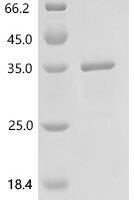 Human Probable methylthioribulose-1-phosphate dehydratase (APIP) Recombinant Protein, C-His - BioCrest Sci