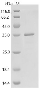 Human Probable methylthioribulose-1-phosphate dehydratase (APIP) Recombinant Protein, C-His, E.coli, C-terminal 6xHis-tagged, 34.0 kDa, purity >≥ 90% as determined by SDS-PAGE.