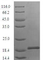 Alternaria alternata Heat shock 70 kDa protein (HSP70), partial Recombinant Protein, N-His, aa 1–152, E.coli - BioCrest Sci