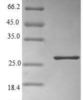 Human Alpha-1-acid glycoprotein 2 (ORM2) Recombinant Protein - BioCrest Sci