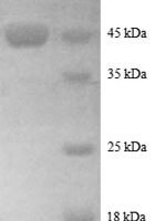 Human ADP-ribosylation factor-like protein 2 (ARL2), partial Recombinant Protein - BioCrest Sci