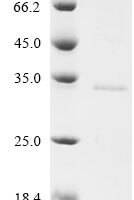 Suregada multiflora Ribosome-inactivating protein gelonin (GEL) Recombinant Protein - BioCrest Sci