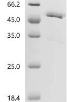 Mouse Tumor necrosis factor ligand superfamily member 12 (Tnfsf12), partial Recombinant Protein, N-hFc1/C-10His - BioCrest Sci