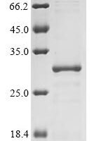 Coxiella burnetii Chaperonin GroEL (groEL), partial Recombinant Protein, N-His - BioCrest Sci