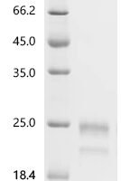 Human Interleukin-1 receptor antagonist protein (IL1RN) Recombinant Protein, C-10His - BioCrest Sci