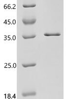 Human RB1-inducible coiled-coil protein 1 (RB1CC1), partial Recombinant Protein, C-His, aa 1396–1594 - BioCrest Sci