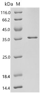 Human RB1-inducible coiled-coil protein 1 (RB1CC1), partial Recombinant Protein, C-His, aa 1396–1594, Homo sapiens (Human), E.coli, C-terminal 6xHis-tagged, 29.4 kDa, purity >≥ 85% as determined by SDS-PAGE.