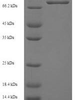Human Ganglioside-induced differentiation-associated protein 2 (GDAP2) Recombinant Protein - BioCrest Sci