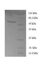 Human Sclerostin domain-containing protein 1 (SOSTDC1) Recombinant Protein, N-GST - BioCrest Sci