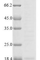 Leuconostoc mesenteroides Dextransucrase, partial Recombinant Protein - BioCrest Sci
