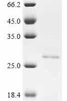 Human Adenylate kinase isoenzyme 4, mitochondrial (AK4) Recombinant Protein - BioCrest Sci