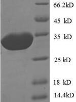 Escherichia coli O157:H7 Peptide deformylase (def) Recombinant Protein - BioCrest Sci