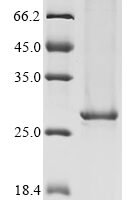 Human Tyrosine-protein kinase BTK (BTK), partial Recombinant Protein - BioCrest Sci