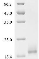 Cat Beta-2-microglobulin (B2M) Recombinant Protein, C-His, aa 21–118, Mammalian cell - BioCrest Sci