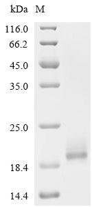 Cat Beta-2-microglobulin (B2M) Recombinant Protein, C-His, aa 21–118, Mammalian cell, Felis catus (Cat) (Felis silvestris catus), Mammalian cell, C-terminal 6xHis-tagged, 13.6 kDa, purity >≥ 90% as determined by SDS-PAGE.
