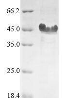Candida albicans Hyphal wall protein 1 (HWP1), partial Recombinant Protein - BioCrest Sci