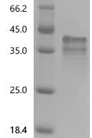 Rat Apolipoprotein C-I(Apoc1) Recombinant Protein - BioCrest Sci