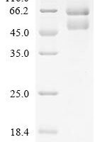 Dog tissue kallikrein (KLK5), partial Recombinant Protein, C-hFc1 - BioCrest Sci