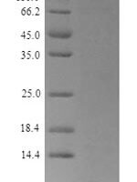 Pandinus impeRator Pandinin-2 Recombinant Protein - BioCrest Sci
