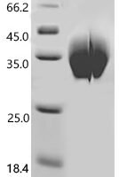 Macaca fascicularis C-type lectin domain family 5 member A (CLEC5A) Recombinant Protein - BioCrest Sci