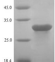 Pig Growth hormone receptor (GHR), partial Recombinant Protein, C-His - BioCrest Sci