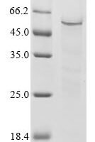 Human Zinc finger and SCAN domain-containing protein 1 (ZSCAN1) Recombinant Protein - BioCrest Sci