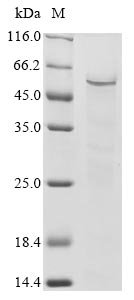 Human Zinc finger and SCAN domain-containing protein 1 (ZSCAN1) Recombinant Protein, Homo sapiens (Human), Baculovirus, N-terminal 10xHis-tagged and C-terminal Myc-tagged, 49.2 kDa, purity >≥ 85% as determined by SDS-PAGE.