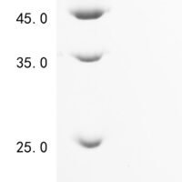 Recombinnant Human Protein lin-28 homolog A (LIN28A), partial Recombinant Protein - BioCrest Sci