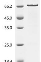 Rat Chondroitin sulfate proteoglycan 5 (Cspg5), partial Recombinant Protein - BioCrest Sci