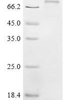 Human E3 ubiquitin-protein ligase XIAP (XIAP)(E134D) Recombinant Protein - BioCrest Sci