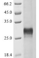 Human Protein Wnt-5a (WNT5A), partial Recombinant Protein - BioCrest Sci