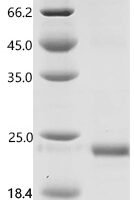 Pig Platelet-derived growth factor subunit B, partial Recombinant Protein - BioCrest Sci