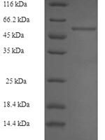 Rabbit Fructose-bisphosphate aldolase B (ALDOB) Recombinant Protein, N-His-SUMO - BioCrest Sci