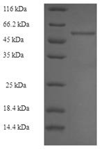 Rabbit Fructose-bisphosphate aldolase B (ALDOB) Recombinant Protein, N-His-SUMO, Oryctolagus cuniculus (Rabbit), E.coli, N-terminal 6xHis-SUMO-tagged, 55.5 kDa, purity >≥ 90% as determined by SDS-PAGE.