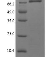 Human Methionine aminopeptidase 2 (METAP2) Recombinant Protein, N-10His/C-Myc - BioCrest Sci