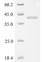 Human Adhesion G-protein coupled receptor G6 (ADGRG6), partial Recombinant Protein, N-His - BioCrest Sci