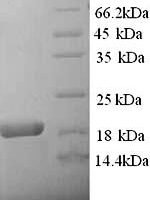 Rat Alpha-2-macroglobulin (A2m), partial Recombinant Protein - BioCrest Sci