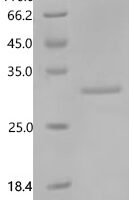 Human Somatotropin (GH1) Recombinant Protein, C-His - BioCrest Sci