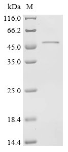 Bovine Paraneoplastic antigen Ma1 homolog (PNMA1) Recombinant Protein, Bos taurus (Bovine), E.coli, N-terminal 10xHis-tagged and C-terminal Myc-tagged, 47.1 kDa, purity >≥ 95% as determined by SDS-PAGE.